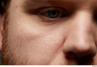 HD Face skin Michael Summers cheek face nose sin texture…